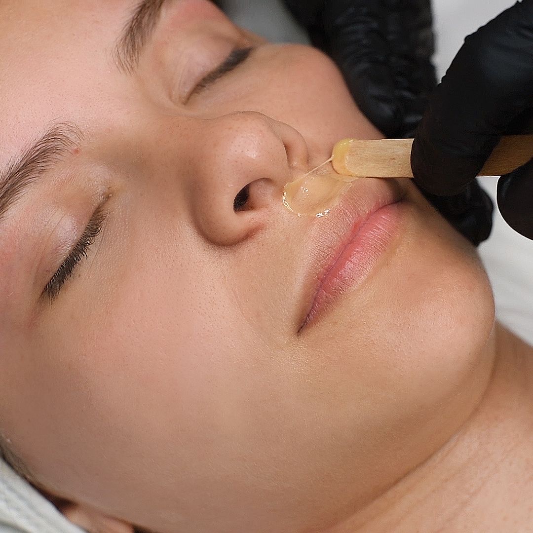 Depilación Rostro Querétaro